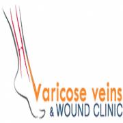 varicoseveinlaser